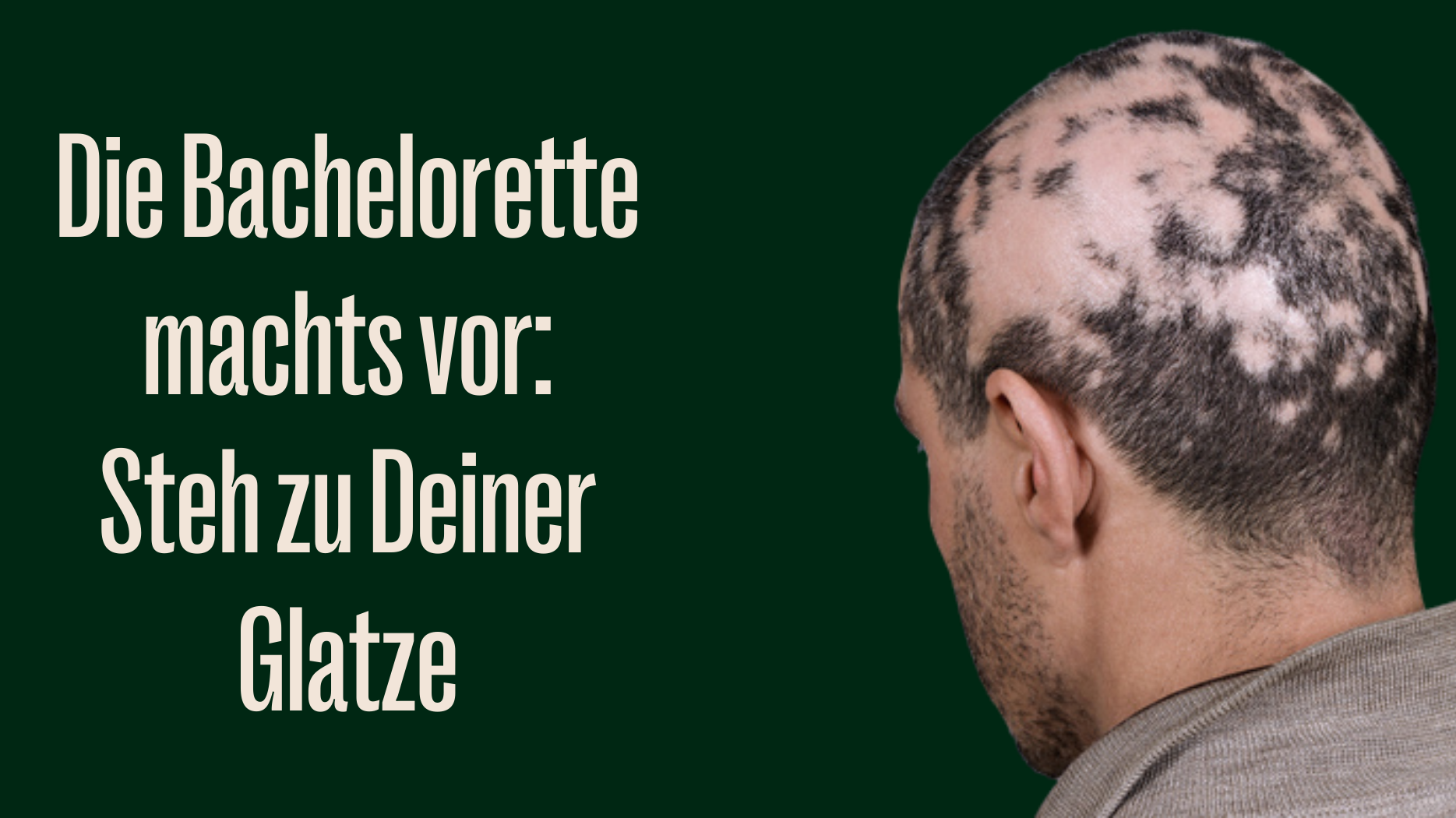 Bachelorette Sharon Battiste steht zur Glatze