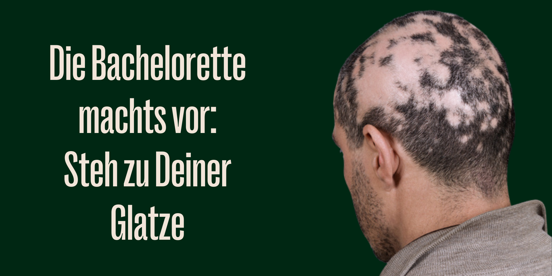 Bachelorette Sharon Battiste steht zur Glatze