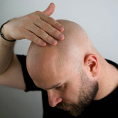 Pflege für Deine Glatze