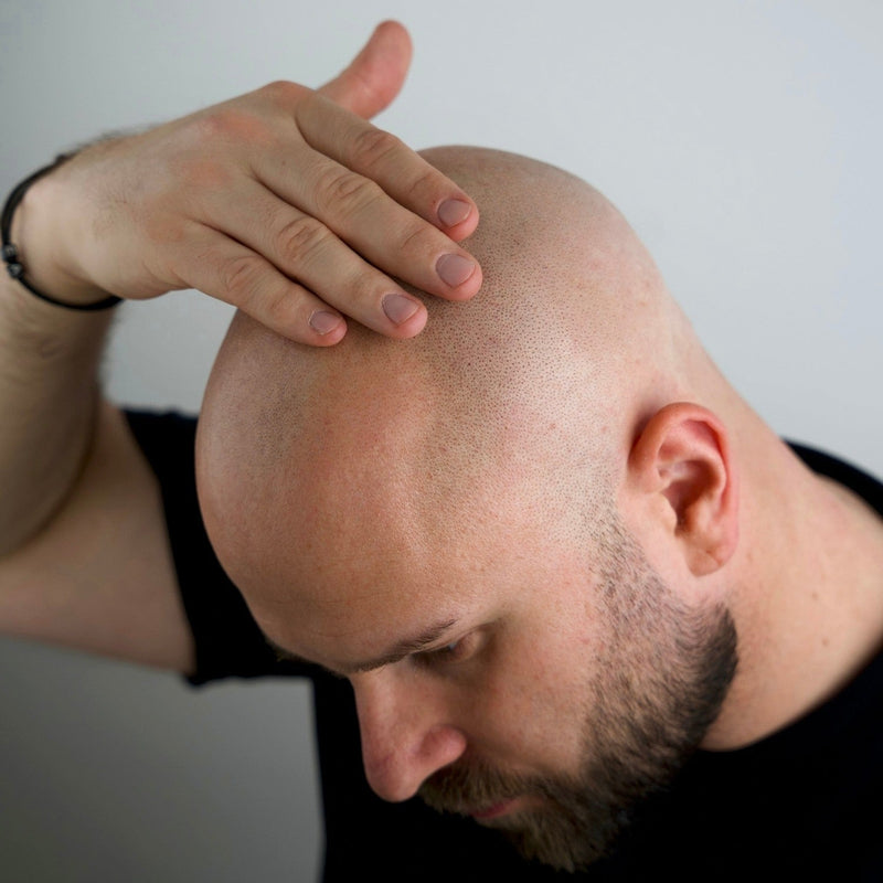 Pflege für Deine Glatze